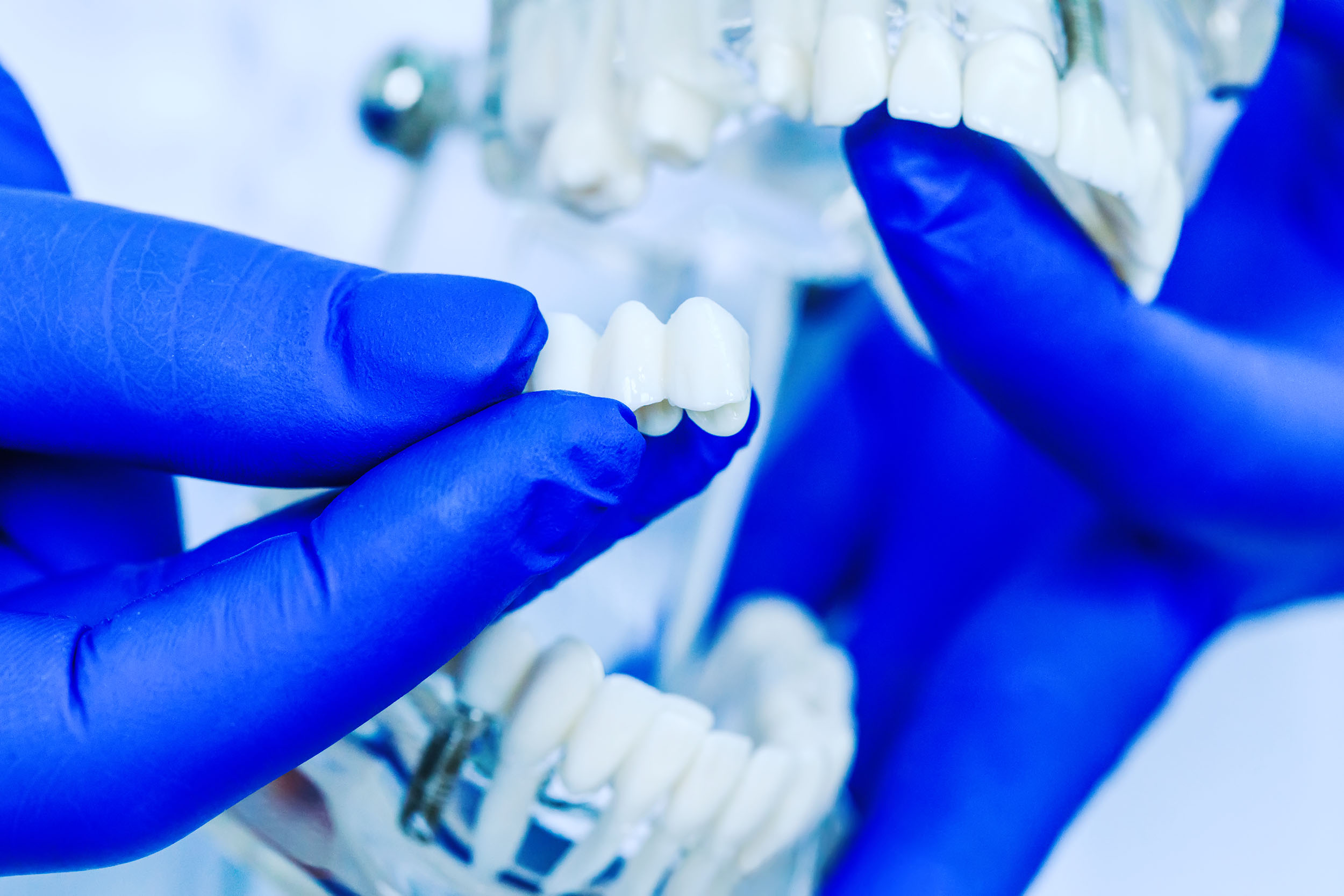 Doctor,Hands,Holding,Teeth,Model,In,Dental,Clinic.,Teeth,Model