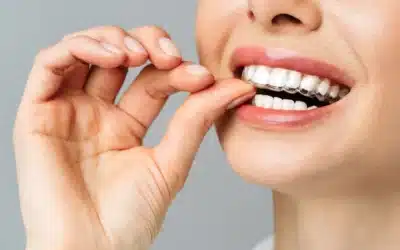 Invisalign® vs traditional braces